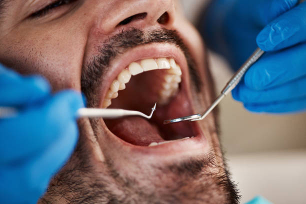 Best Walk-In Emergency Dentist in Green Forest, AR